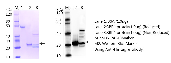 RBP4 SDS-PAGE western blot RBP4 SDS-PAGE western blot