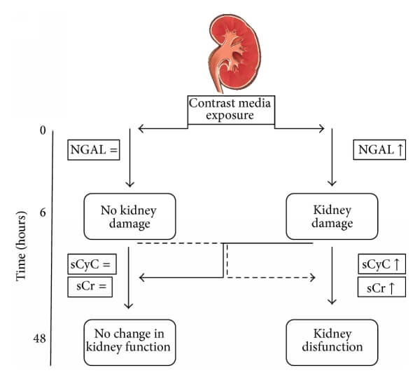 胱抑素C（CysC）與NGAL、肌酐的關系