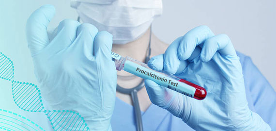 SingleB單抗發現技術攻克PCT檢測靈敏度難題 